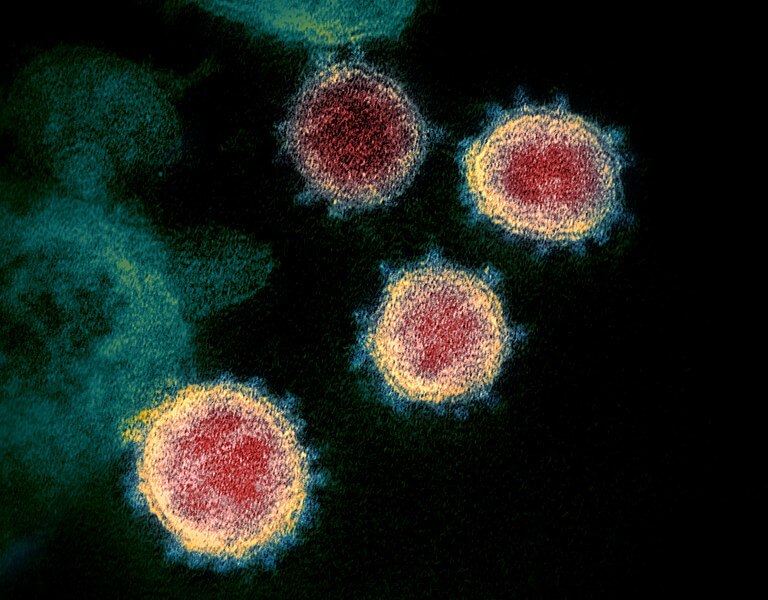 Novel Coronavirus SARS-CoV-2 Pandemic